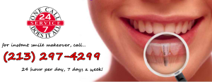 dental implants los angeles